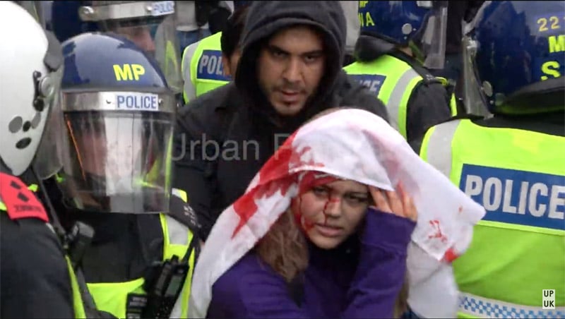 Bloodied England fan at Euro 2021